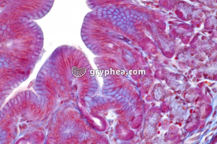 Estomac pylorique x160 - gryphea.com